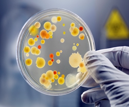 A person holding a petri dish with bacteria on it, engaged in topical drug product manufacturing.